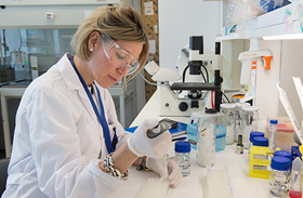El grupo de investigación Neurometabolismo del Hospital Nacional de Parapléjicos sigue aportando luz a la investigación de la ELA