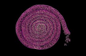 Una fotografía realizada en el Hospital Nacional de Parapléjicos, galardonada en la modalidad Micro de FOTCIENCIA21